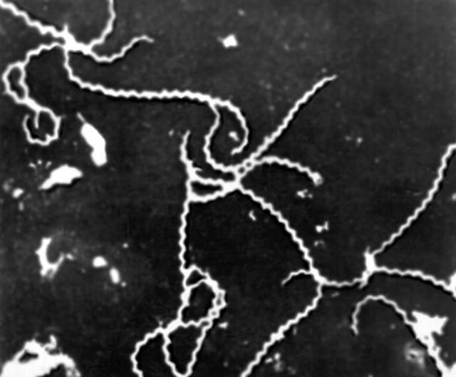 Электронограмма лептоспир