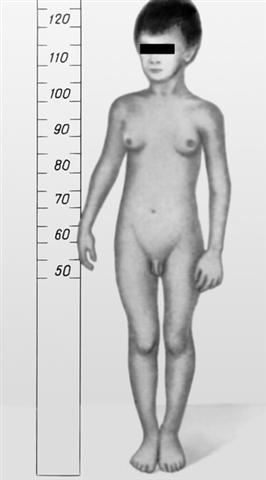 Мальчик 6 лет с патологической феминизацией