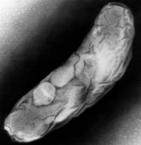 Микобактерии туберкулеза в препарате мокроты