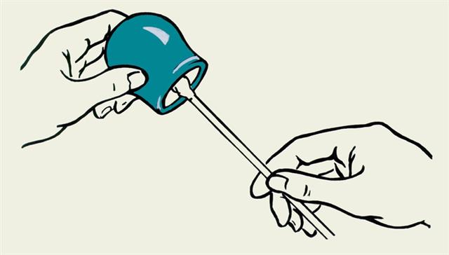 Схематическое изображение процедуры постановки медицинских банок