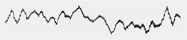 ЭКГ при мерцании желудочков