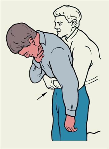 Приемы первой помощи пострадавшему, находящемуся в сознании, при аспирации инородного тела