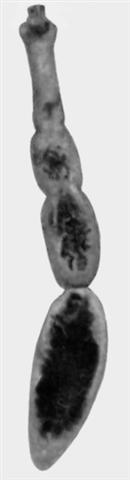 Зрелый альвеококк из кишечника собаки