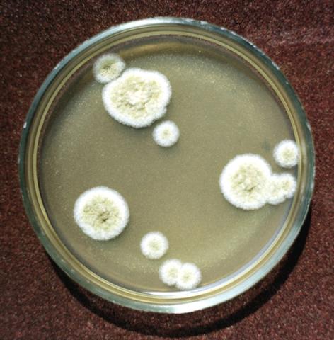 Колонии грибка Aspergillus flavus на среде Сабуро