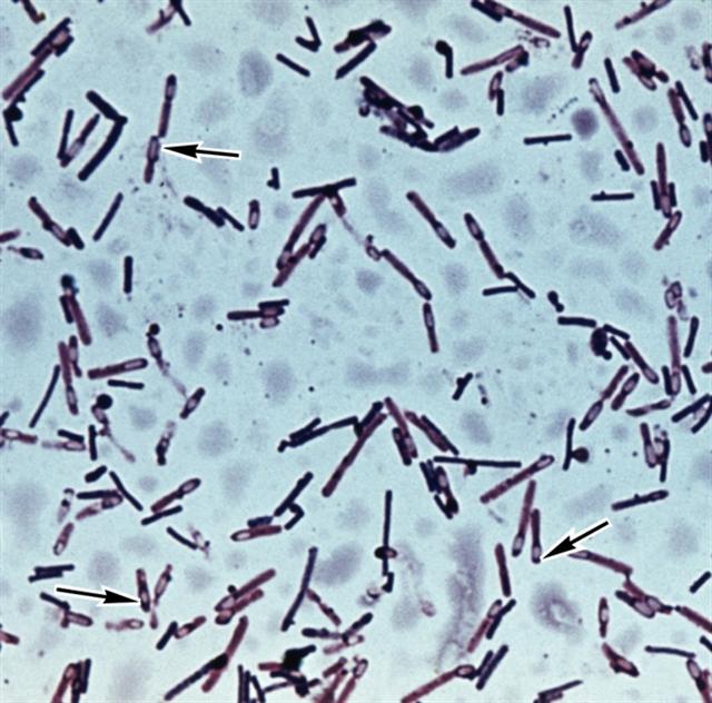 Чистая культура Clostridium perfrindens.