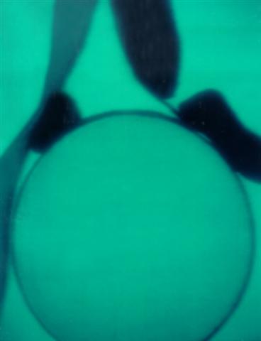 Схема тазобедренного сустава с 2 типом строения