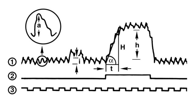 Основные элементы окклюзионной плетизмограммы