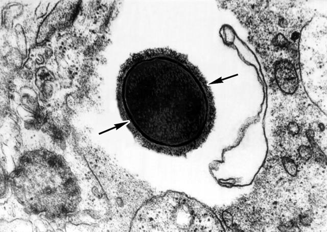 Электронограмма ультратонкого среза пневмококка, образующего капсулу
