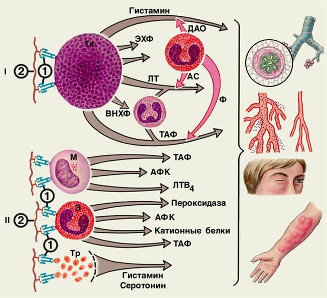 Общий механизм развития аллергической реакции немедленного типа